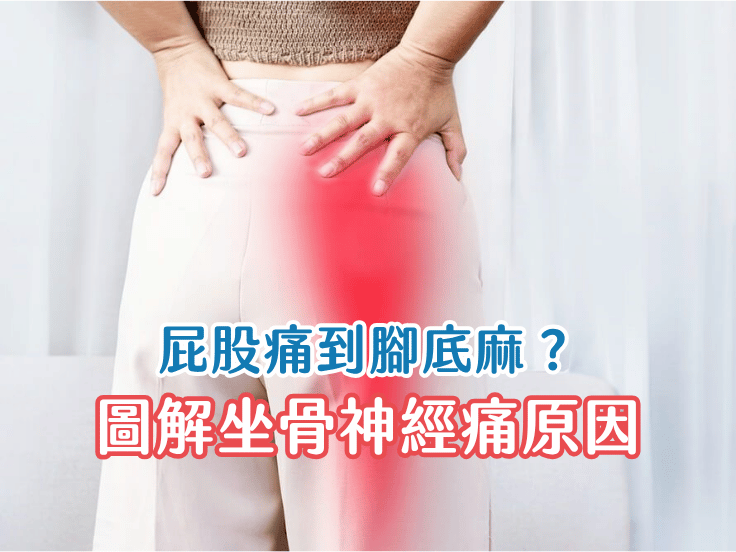 屁股痛到腳底麻？唯心運動醫療體系物理治療師圖解坐骨神經痛原因與壓迫位置
