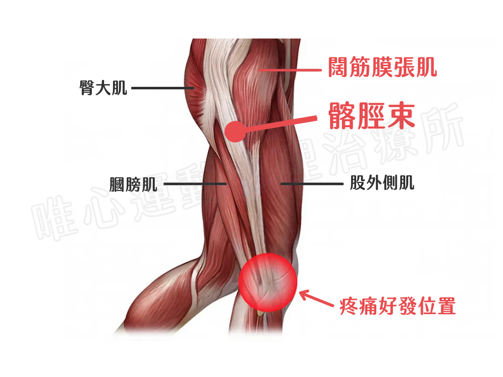 膝蓋外側痛怎麼辦？髂脛束症候群（跑者膝） vs. 韌帶損傷 解析與改善方法｜桃園物理治療