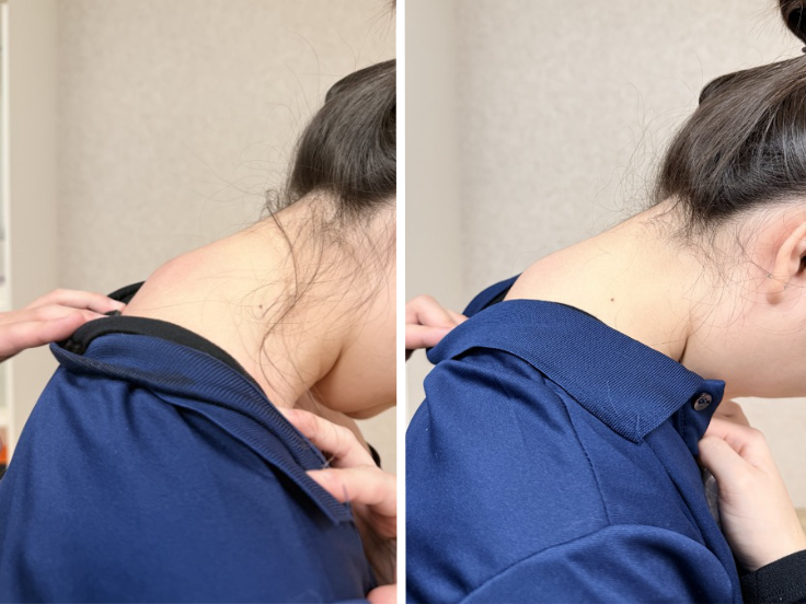 唯心運動醫療體系富貴包消除案例：治療前後頸部曲線對比