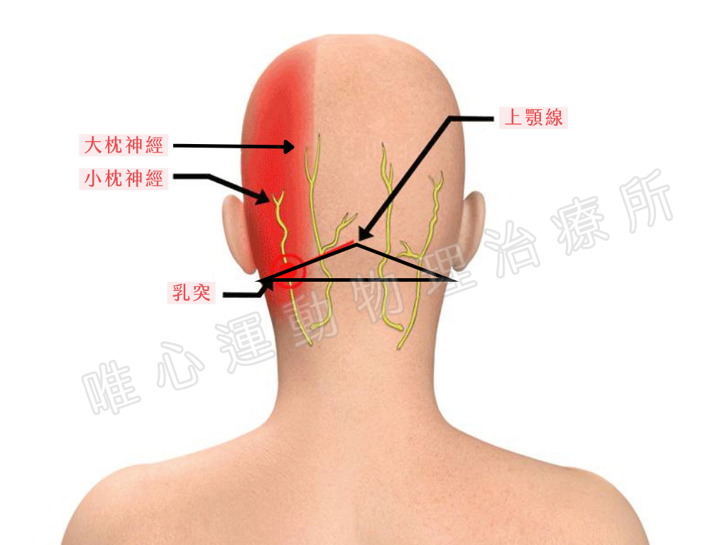 長時間用電腦或愛追劇到後腦勺痛、眼壓高，可能是壓到枕神經了！｜桃園物理治療
