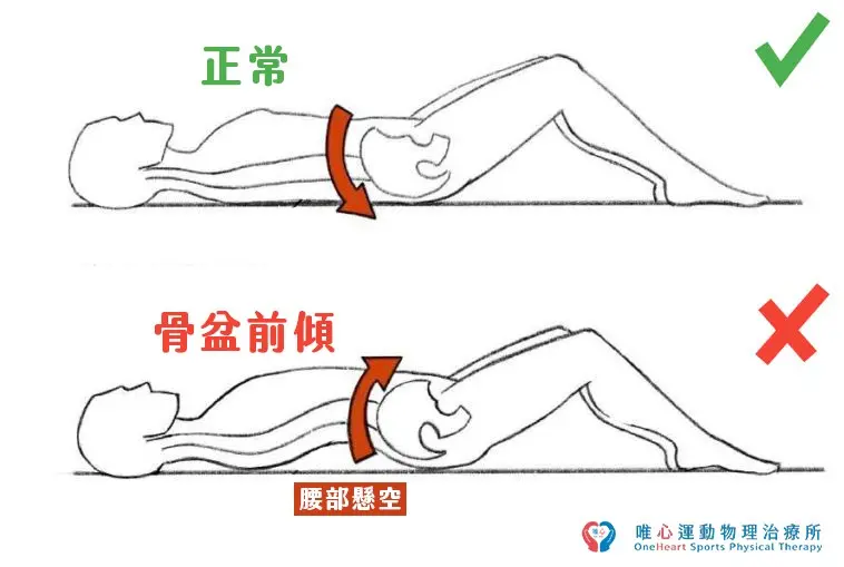 唯心運動醫療體系：解析骨盆前傾與床墊支撐力的關聯，預防起床腰部緊縮痠痛