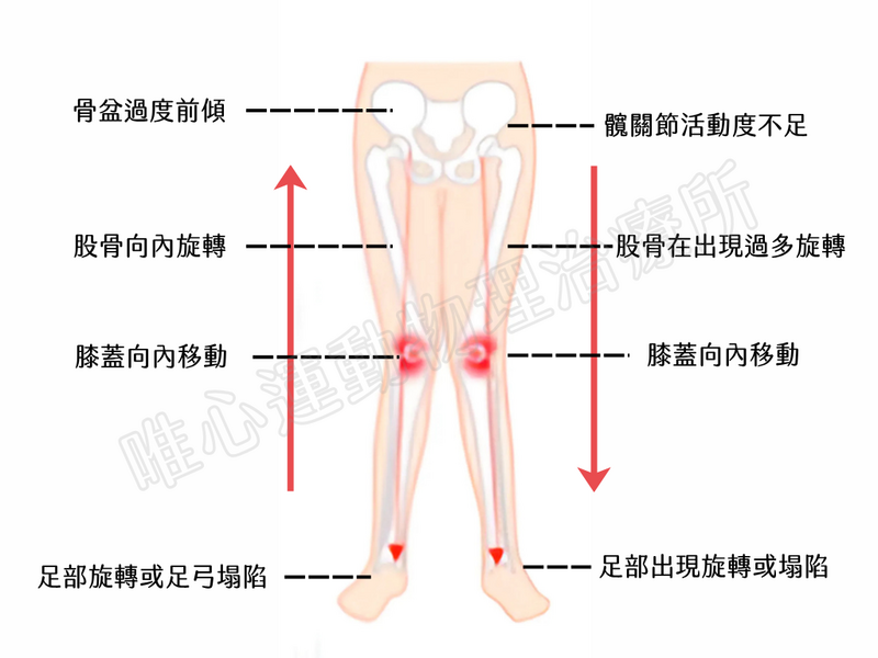 唯心運動醫療體系：腿型矯正骨性結構與功能性問題分析表