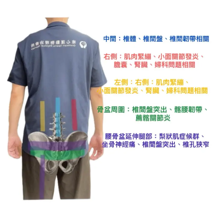 唯心運動醫療體系：物理治療師製作下背痛位置對照表圖表，提供民眾進行初步簡易自我檢測