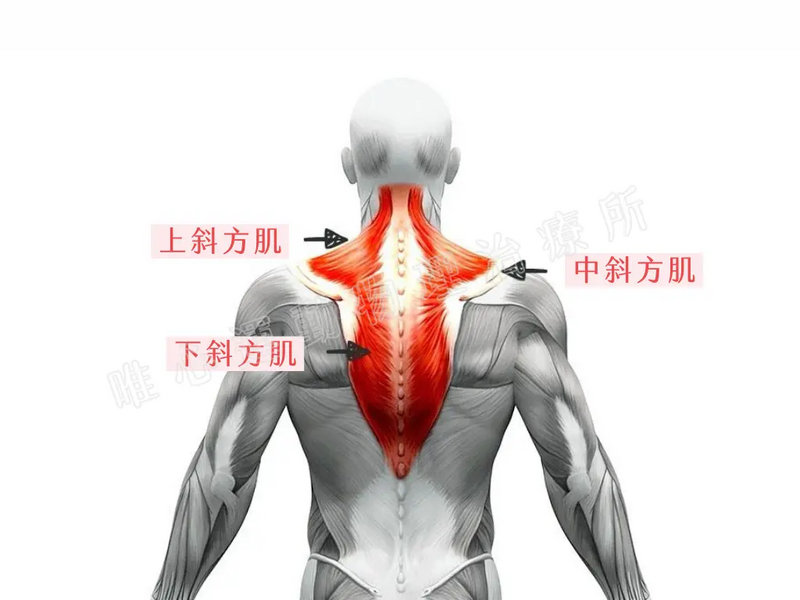 唯心運動醫療體系:物理治療師解說上斜方肌緊繃與周邊肌肉結構失衡引起的肩頸痠痛僵硬症狀