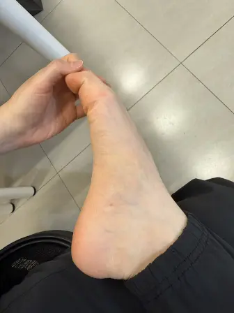 唯心運動醫療體系:物理治療師示範腳背痛舒緩方式:坐姿腳趾伸展